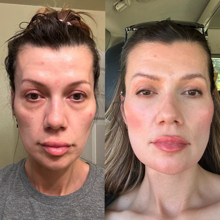 Loreey before and after